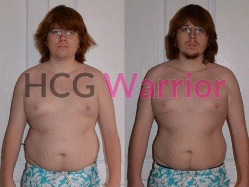 a picture of a man with red hair and glasses with no shirt on that lost 22 pounds doing the hcg protocol