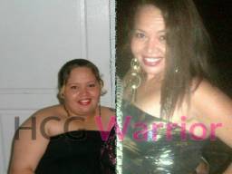 woman from Cayman Islands who lost 125 pounds with hcg warrior drops